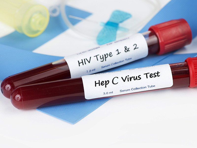 HivHepatitisTest