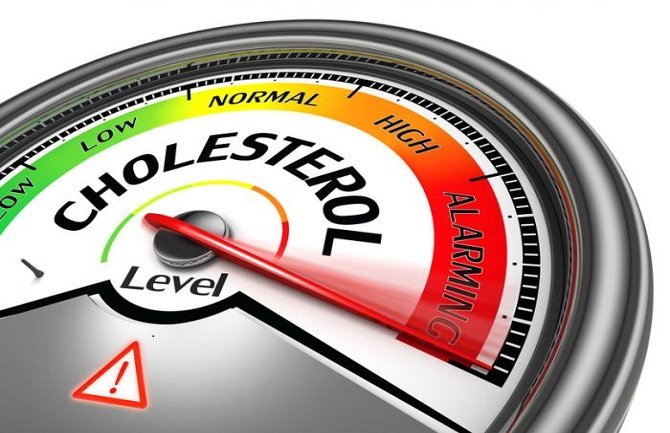 Ne zanemarujte ove signale: Upućuju na povišen holesterol