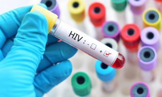 Zbog HIV statusa građani u CG ostaju i bez posla