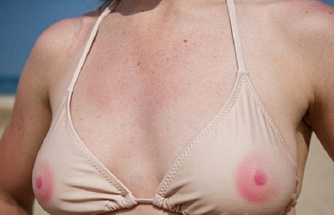 Niste dovoljno hrabri za toples: Novi hit bikini! (FOTO) 