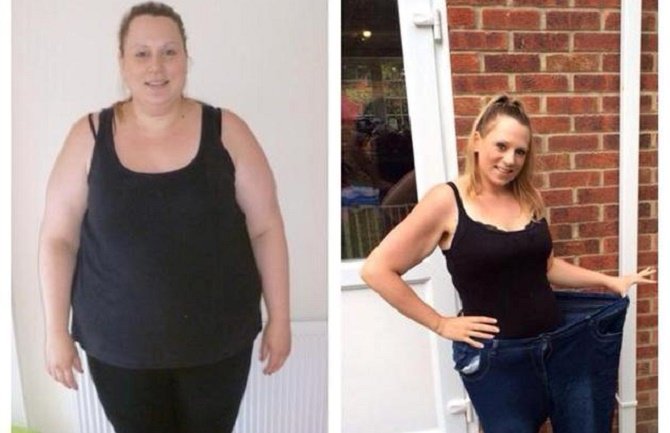 Zamalo da ubijem bebu svojom debljinom (FOTO)