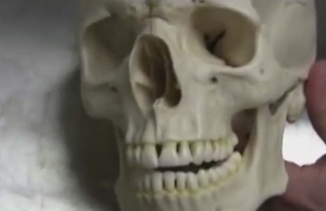 Uhapšena Belgijanka kod koje je na aerodromu pronađena ljudska lobanja