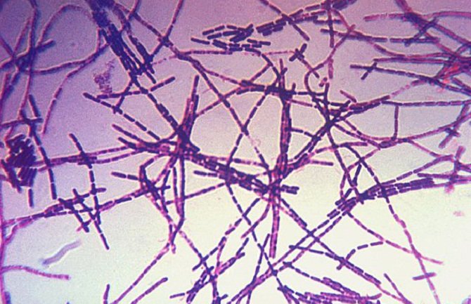 SAD: Nova afera s antraksom