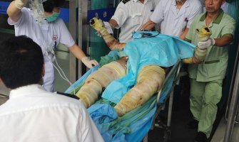 U Kineskoj fabrici izbila eksplozija, ljudi živi gorjeli! (FOTO)