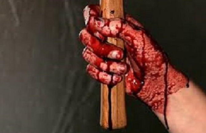 Tukla snahu daskom, sin vratio motkom