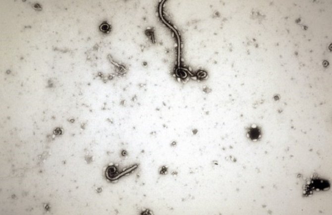 Norvežanin zaražen ebolom