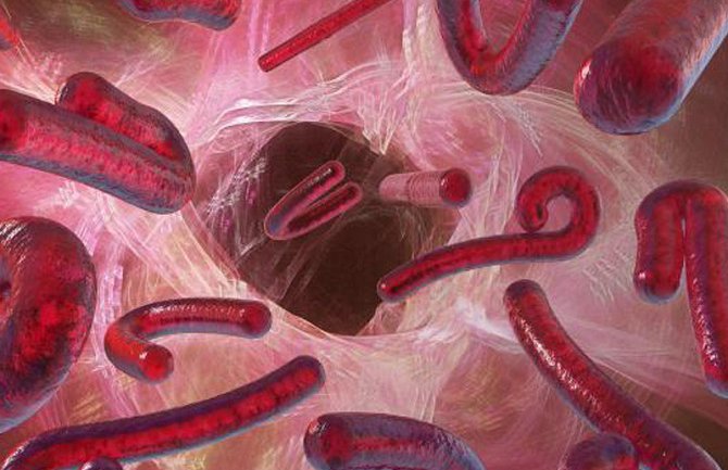 Prvi slučaj širenja ebole u Evropi: Ebolom zaražena medicinska sestra