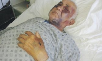 Pretučeni Pljevljak: Stariji sin me je tukao dok se nijesam onesvijestio