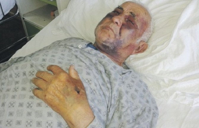 Pretučeni Pljevljak: Stariji sin me je tukao dok se nijesam onesvijestio