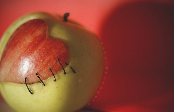 Doniranje organa čin suštinske vjere i ljubavi