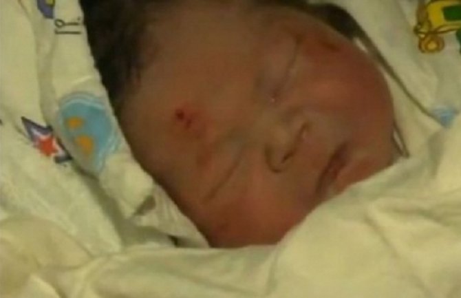  Vijera: Beba preživjela pad sa trećeg sprata