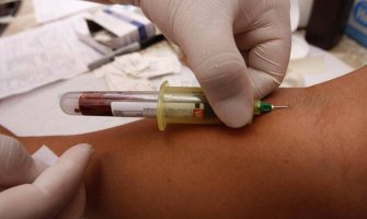 HIV otkriven kod još 17 osoba u Crnoj Gori