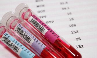 Zbog OVIH razloga morate znati svoju krvnu grupu