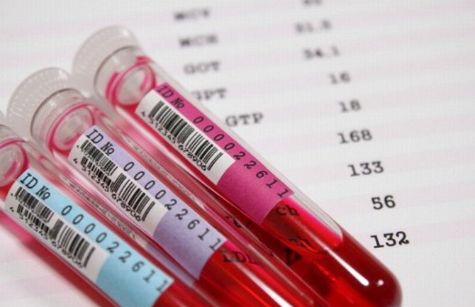 Zbog OVIH razloga morate znati svoju krvnu grupu