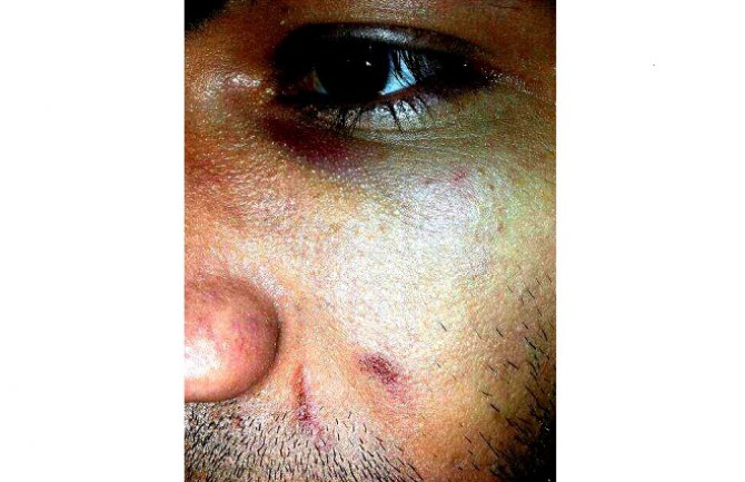 Napadnuti R.B.: Kriv sistem ne dijete