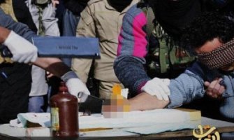 Zbog krađe ostao bez ruke, išiban jer je gledao porniće