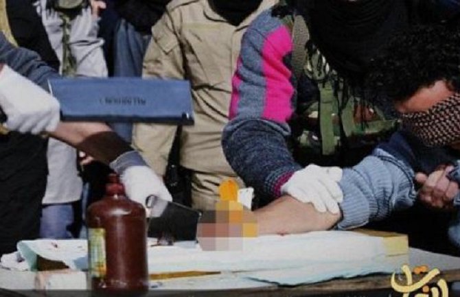 Zbog krađe ostao bez ruke, išiban jer je gledao porniće