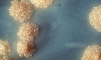 Otkriven antibiotik koji savladava otpor superbakterija
