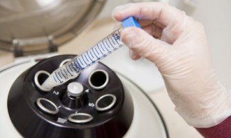  Fond povrijedio pravo na vještačku oplodnju