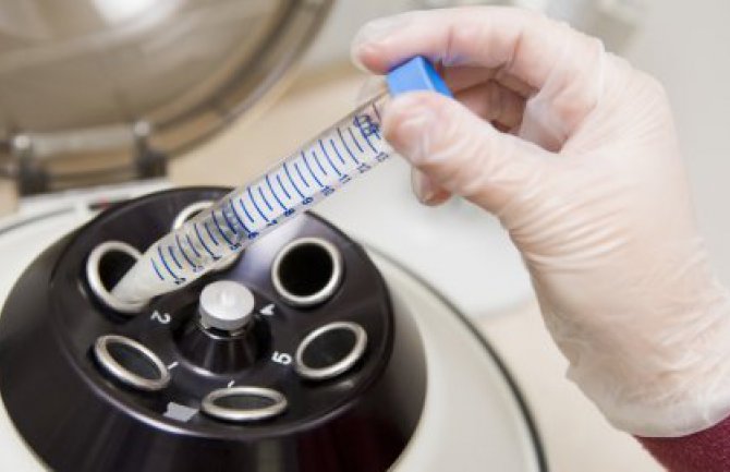  Fond povrijedio pravo na vještačku oplodnju