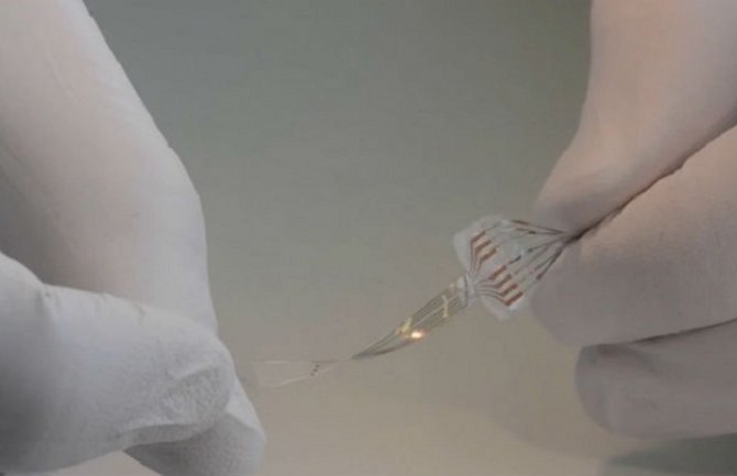 Paralizovani pacovi prohodali zahvaljujući implantu