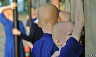 Tanzanija: U šumi pronađeno izmasakrirano tijelo albino bebe