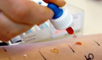 U crnogorskim bolnicama  nema dječijeg alergologa!