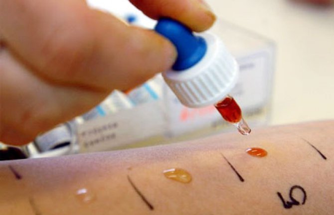 U crnogorskim bolnicama  nema dječijeg alergologa!