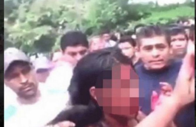 Djevojčicu živu spalili nasred ulice! (FOTO)