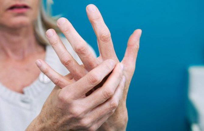 Problemi oboljelih od Multiple Skleroze: Ćudljiva bolest i ćudljivo društvo