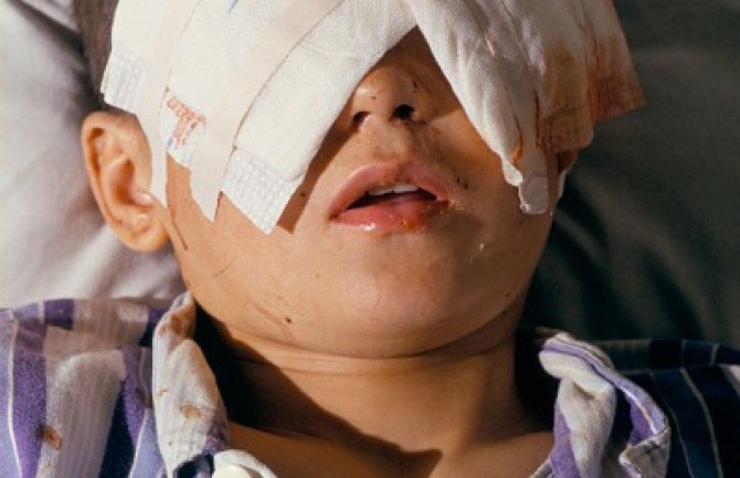 Komšinica iskopala dječaku oči pa se ubila