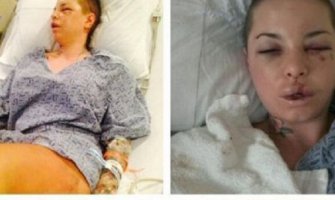 Bivši MMA borac polomio djevojci 18 kostiju, a njegovi argumenti su nevjerovatni