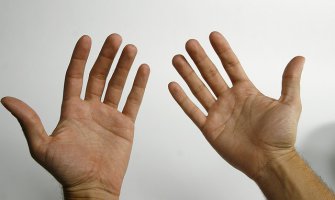 Ukoliko imate ove četiri linije na zglobu, vi ste vrlo posebna osoba