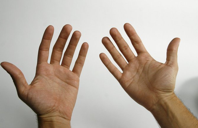 Ukoliko imate ove četiri linije na zglobu, vi ste vrlo posebna osoba
