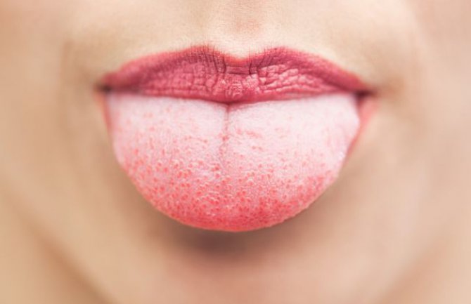 Prvi znakovi svih bolesti vide se na jeziku