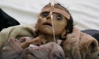 Evo kakva se priča krije iza fotografije ovog dječaka