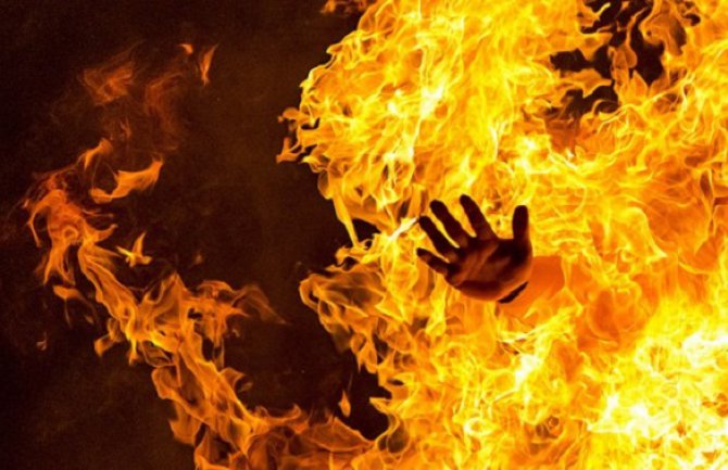 Tražila azil u Australiji:  Djevojka  se zapalila u izbjegličkom kampu na otoku Nauru