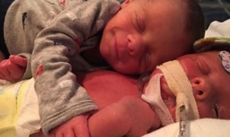 Fotografija braće blizanaca koja je rasplakala svijet