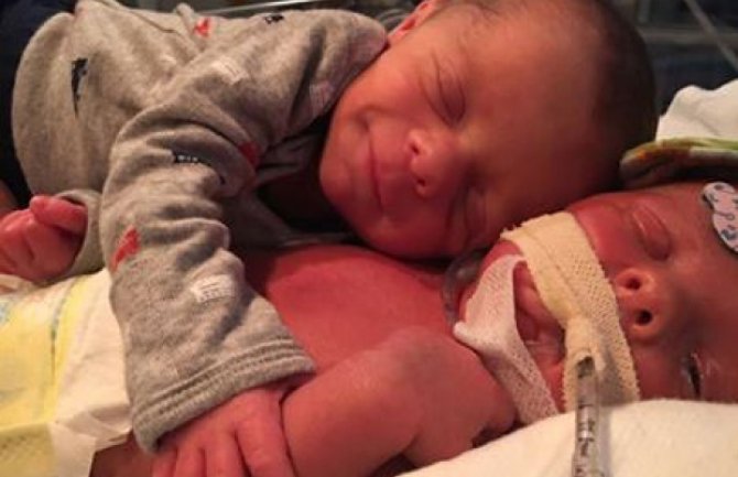 Fotografija braće blizanaca koja je rasplakala svijet