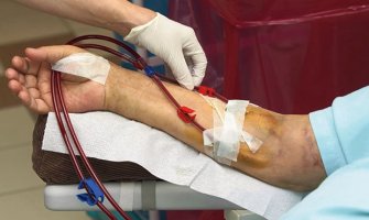 Uskoro dijaliza i na Cetinju