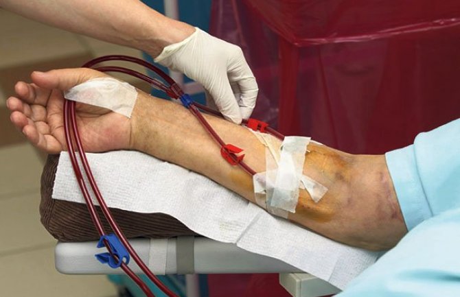 Uskoro dijaliza i na Cetinju