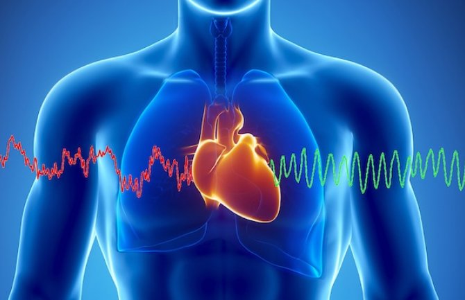 Alarmantni podaci za CG: Svaka druga osoba umire od bolesti srca i krvnih sudova