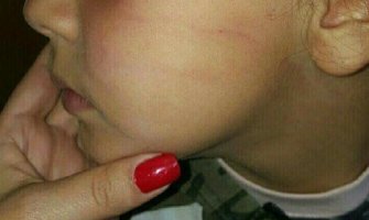 Otac učenice: Udario pesnicom o sto i odvalio joj šamarčinu; Učitelj: Pokušao sam da je spasim da ne padne