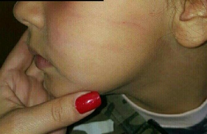 Otac učenice: Udario pesnicom o sto i odvalio joj šamarčinu; Učitelj: Pokušao sam da je spasim da ne padne