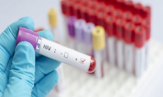 Sa HIV-om se danas živi! 