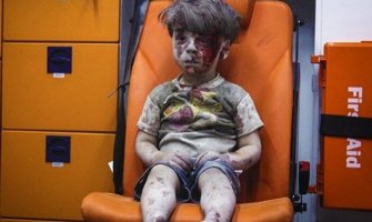Ovako izgleda Oman, ranjeni dječak iz Sirije čija je fotografija potresla svijet (FOTO/VIDEO)
