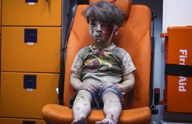 Ovako izgleda Oman, ranjeni dječak iz Sirije čija je fotografija potresla svijet (FOTO/VIDEO)