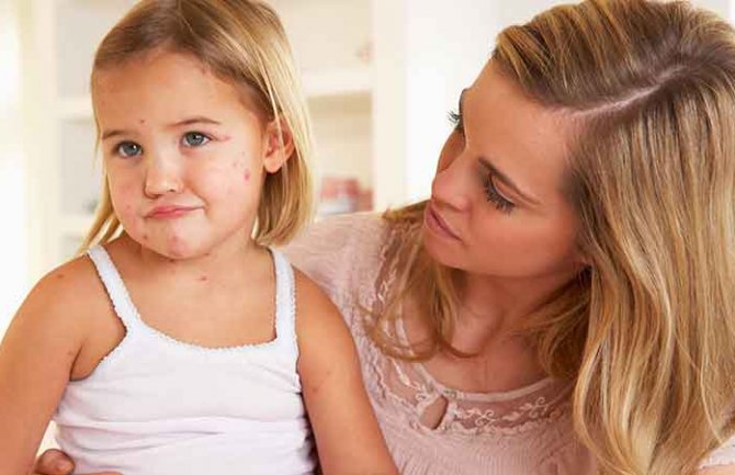 Institut za javno zdravlje: Roditelji da se ne igraju sa zdravljem svoje djece