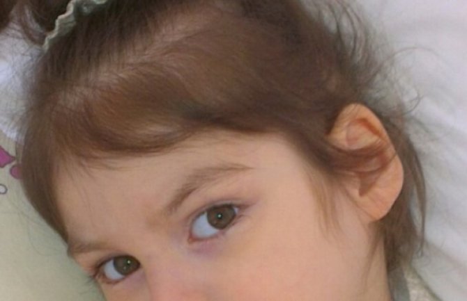 Četvorogodišnjoj Sofiji Šušić iz Nikšića potrebna pomoć za liječenje