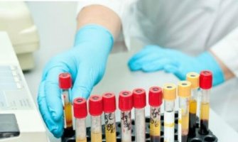 Laboratorijske nalaze će uskoro objavljivati na sajtu